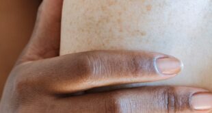 Close-up of diverse hands touching freckled skin, highlighting unity and diversity.