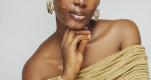Close-up portrait of a confident Black woman in yellow knitwear, highlighting natural beauty and style.