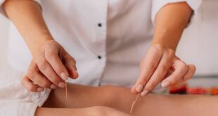 Close-up of professional performing acupuncture on a client's knee indoors.